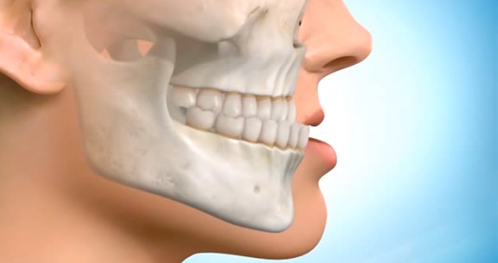 Konya Ortodonti -Çarpık & Yamuk Diş ve Çene Tedavisi