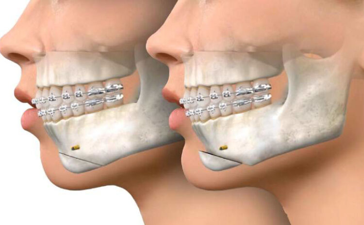 Diş Hekimliği Uzmanlık Alanları